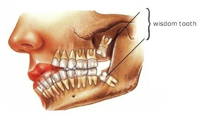 IQRA DENTAL CLINIC KUNDOOR - ATHANI