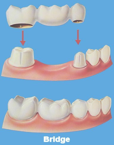 IQRA DENTAL CLINIC KUNDOOR - ATHANI